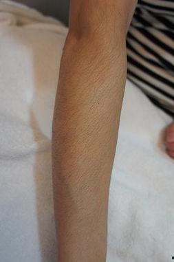 女性脱毛过程视频,轻松掌握美丽秘诀